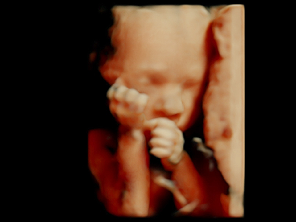 3D Ultraschall, Schwangerschaftsbetreuung | Woman & Health, 1010 Wien
