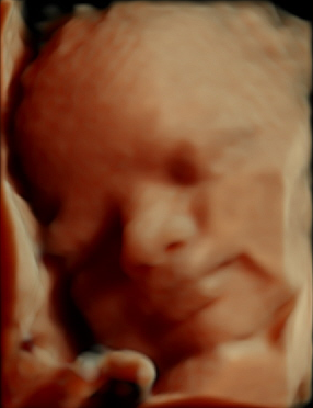 Baby 3D Ultraschall 27. SSW