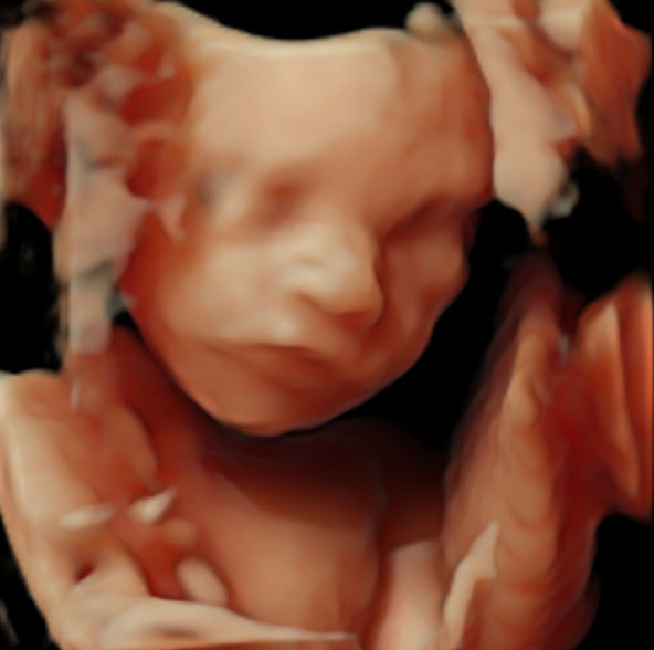 3D Ultraschall in der 37. Schwangerschaftswoche
